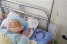 Bác sĩ viện huyện “mở sọ” dẫn lưu máu tụ trong não cứu cụ bà 76 tuổi bị hôn mê